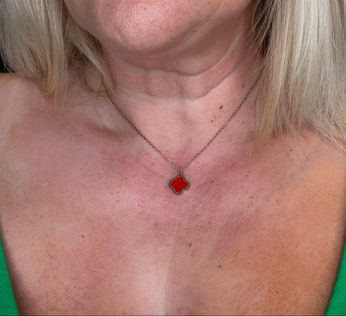 Close-up of a person with blonde hair and a red pendant necklace.